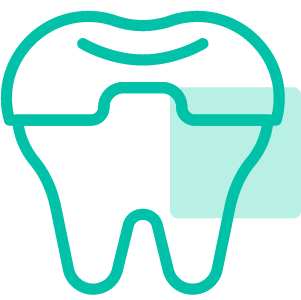 Braces and Aligners